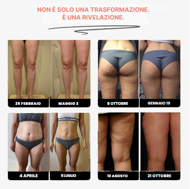Leggings Anticelulíticos 3D FittaBella Sculptura Redefine tu Silueta