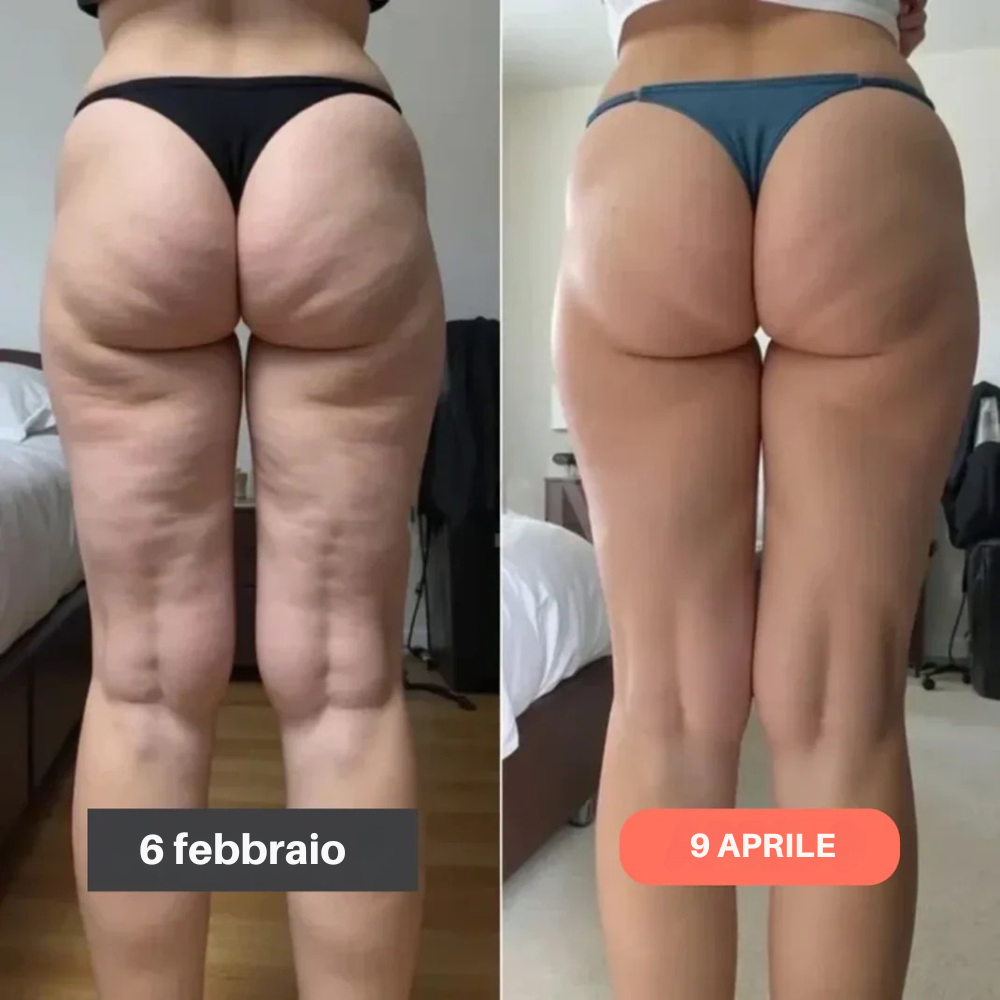 Leggings Anticelulíticos 3D FittaBella Sculptura Redefine tu Silueta