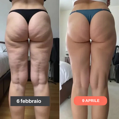 Leggings Anticelulíticos 3D FittaBella Sculptura Redefine tu Silueta