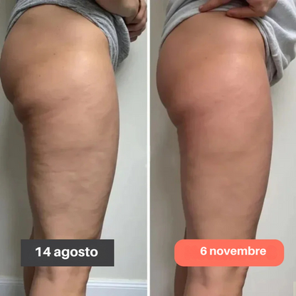 Leggings Anticelulíticos 3D FittaBella Sculptura Redefine tu Silueta